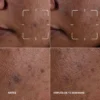 2331 (2) Even Better Clinical Dark Spot Clearing Serum