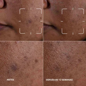 Even Better Clinical Dark Spot Clearing Serum