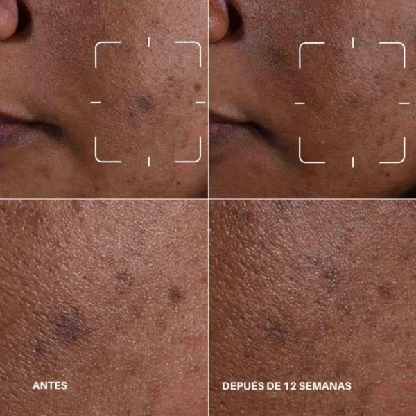 2331 (2) Even Better Clinical Dark Spot Clearing Serum